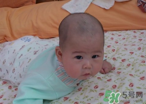 新生兒身上有黑毛是怎么回事?新生兒有黑毛正常嗎? 新生兒身上有黑毛是怎么回事?新生兒有黑毛正常嗎?