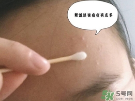 星期四農(nóng)莊茶樹精油怎么用？星期四農(nóng)莊茶樹精油使用方法