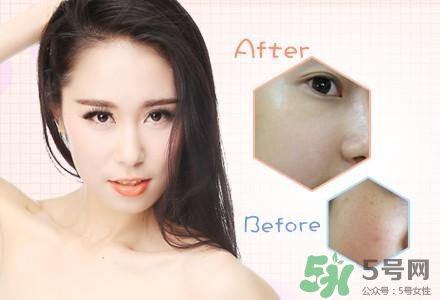 水氧嫩膚多久做一次?水氧嫩膚效果怎么樣? 水氧嫩膚多久做一次?水氧嫩膚效果怎么樣?