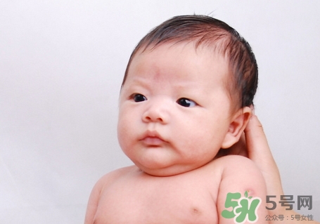 新生兒臉上長小白點是怎么回事?是什么原因? 新生兒臉上長小白點是怎么回事?是什么原因?