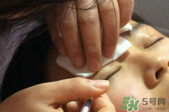 埋線雙眼皮需要拆線嗎？埋線雙眼皮怎么拆線