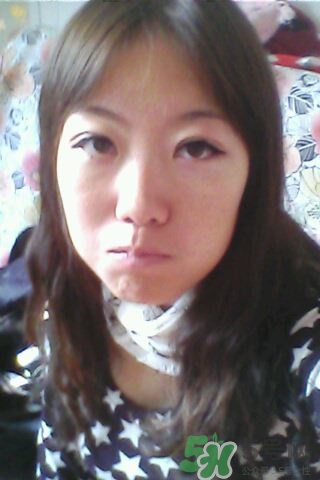 什么是定點(diǎn)雙眼皮？定點(diǎn)雙眼皮多少錢(qián)？