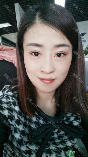 埋線雙眼皮能保持多久？埋線雙眼皮是永久嗎