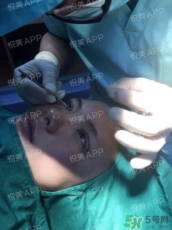 定點雙眼皮恢復過程圖_定點雙眼皮要多久恢復 定點雙眼皮恢復過程圖_定點雙眼皮要多久恢復