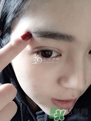 什么是定點(diǎn)雙眼皮？定點(diǎn)雙眼皮多少錢(qián)？