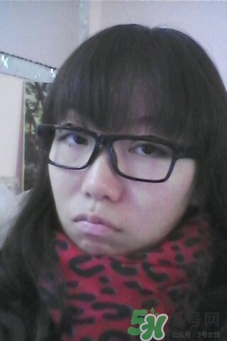 什么是定點(diǎn)雙眼皮？定點(diǎn)雙眼皮多少錢(qián)？