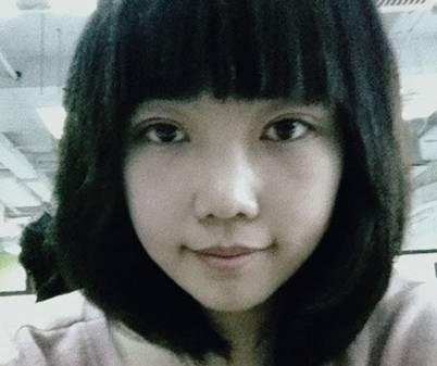 韓式三點(diǎn)雙眼皮是永久嗎？三點(diǎn)雙眼皮能保持多久？