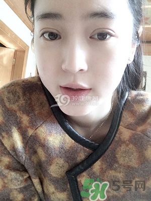 什么是定點(diǎn)雙眼皮？定點(diǎn)雙眼皮多少錢(qián)？