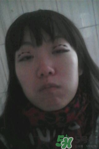 什么是定點(diǎn)雙眼皮？定點(diǎn)雙眼皮多少錢(qián)？