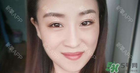 埋線雙眼皮能保持多久？埋線雙眼皮是永久嗎