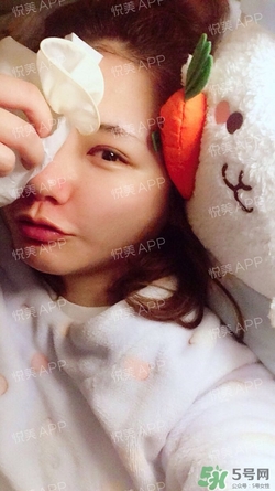 定點雙眼皮恢復過程圖_定點雙眼皮要多久恢復 定點雙眼皮恢復過程圖_定點雙眼皮要多久恢復