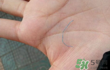 埋線雙眼皮需要拆線嗎？埋線雙眼皮怎么拆線