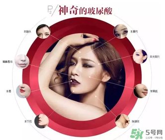 喬雅登是哪個(gè)國家的？喬雅登玻尿酸哪個(gè)國家？