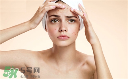 擠完痘痘可以敷面膜嗎?擠完痘痘敷面膜好嗎? 擠完痘痘可以敷面膜嗎?擠完痘痘敷面膜好嗎?