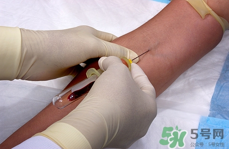 被狗咬了一定要打針嗎?被狗咬了多長時間打針有效 被狗咬了一定要打針嗎?被狗咬了多長時間打針有效