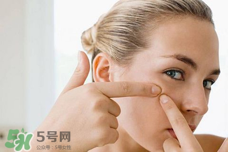 膠原蛋白能祛痘嗎？膠原蛋白可以祛痘嗎？