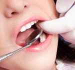 智齒拔完后有個(gè)洞怎么辦？拔智齒后有個(gè)洞多久能長好？