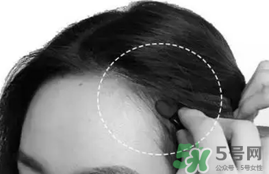 發(fā)際線高適合什么發(fā)型？發(fā)際線高怎么辦