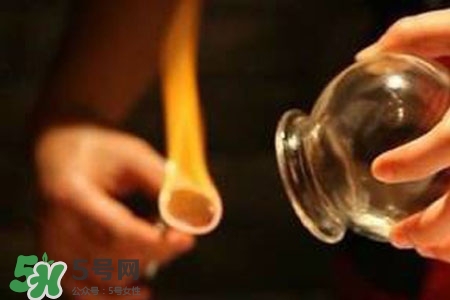 拔罐放血能治皮膚病嗎？拔罐放血能治牛皮癬嗎？