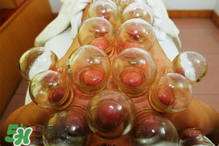 拔罐放血能治皮膚病嗎？拔罐放血能治牛皮癬嗎？