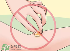 水泡怎么處理？水泡要不要刺破？