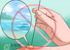 水泡怎么處理？水泡要不要刺破？