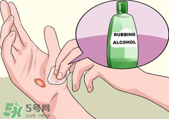 水泡怎么處理？水泡要不要刺破？