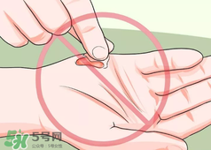 水泡怎么處理？水泡要不要刺破？