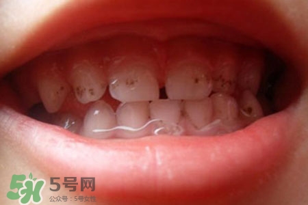 刷牙后吃東西發(fā)苦正常嗎？為什么刷牙后吃東西發(fā)苦？