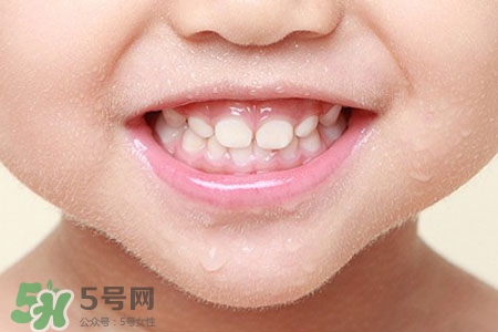 刷牙后吃東西發(fā)苦正常嗎？為什么刷牙后吃東西發(fā)苦？