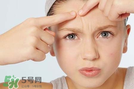 春天臉上冒痘痘怎么辦？為什么春天臉上容易出痘？