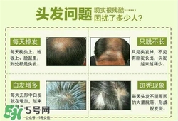 牛角梳梳頭可以生發(fā)嗎？牛角梳怎么梳頭？