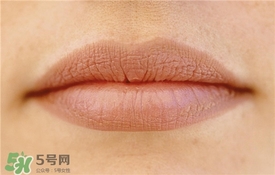 卡唇紋是什么意思？卡唇紋怎么辦？