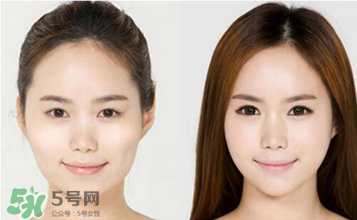 瘦臉針?lè)譃閹追N類(lèi)型？瘦臉針有哪幾個(gè)牌子？