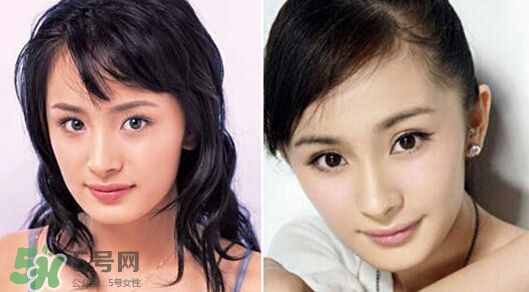 打瘦臉針能懷孕嗎？打瘦臉針能吃避孕藥嗎？