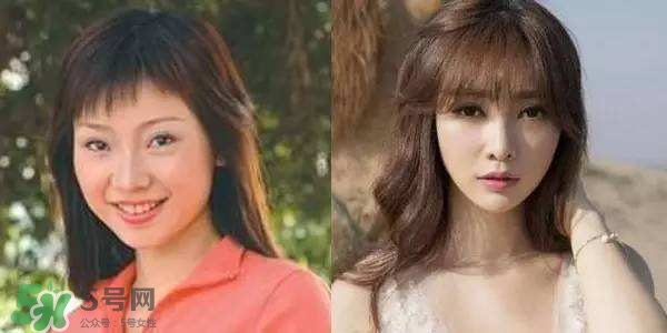 打瘦臉針能懷孕嗎？打瘦臉針能吃避孕藥嗎？