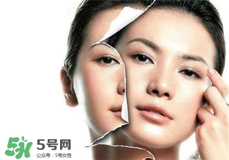 美白針是什么？美白針可以連續(xù)打嗎？