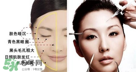 美白針的效果明顯嗎？美白針一個療程幾次？