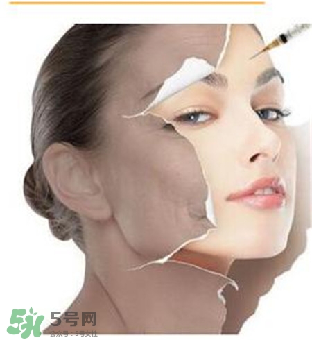 美白針安全嗎？美白針可以自己注射嗎？