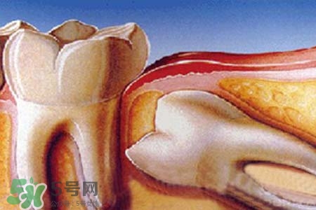 智齒經(jīng)常發(fā)炎怎么辦？智齒反復(fù)發(fā)炎腫痛怎么辦？