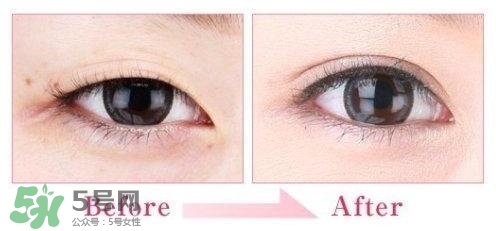 割雙眼皮多少錢(qián)？割雙眼皮最佳年齡