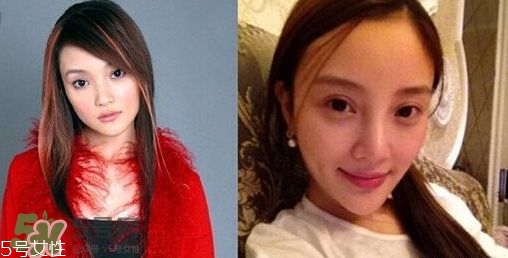 割雙眼皮有幾種做法？雙眼皮有哪幾種形狀？