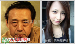 臥蠶是黑眼圈嗎？臥蠶和黑眼圈的區(qū)別