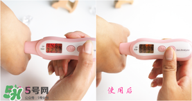 城野醫(yī)生敷完后要洗嗎 城野醫(yī)生敷完要洗掉嗎 城野醫(yī)生敷完后要洗嗎 城野醫(yī)生敷完要洗掉嗎