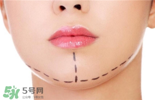 玻尿酸墊下巴能維持多久？玻尿酸墊下巴能維持多長時間？