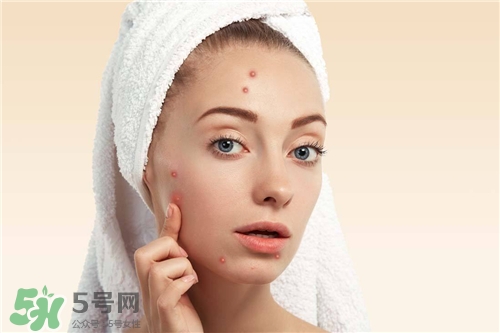 激光祛痘印有副作用嗎？激光去痘印有后遺癥嗎？