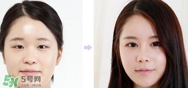 哪些人需要開眼角？需要開眼角的眼睛圖片