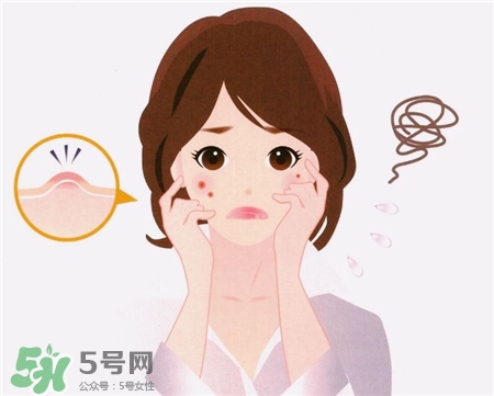 一化妝就長(zhǎng)閉口怎么回事?長(zhǎng)閉口可以化妝嗎? 一化妝就長(zhǎng)閉口怎么回事?長(zhǎng)閉口可以化妝嗎?