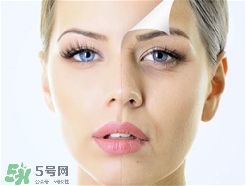 玻尿酸除皺有效果嗎？玻尿酸除皺效果怎么樣？