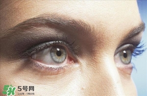 貼雙眼皮過敏怎么辦 一貼雙眼皮就過敏 貼雙眼皮過敏怎么辦 一貼雙眼皮就過敏